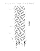 PROSTHESIS AND DELIVERY SYSTEM diagram and image