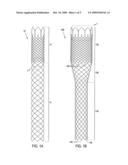 Braided stent and method for its manufacture diagram and image