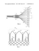 Braided stent and method for its manufacture diagram and image