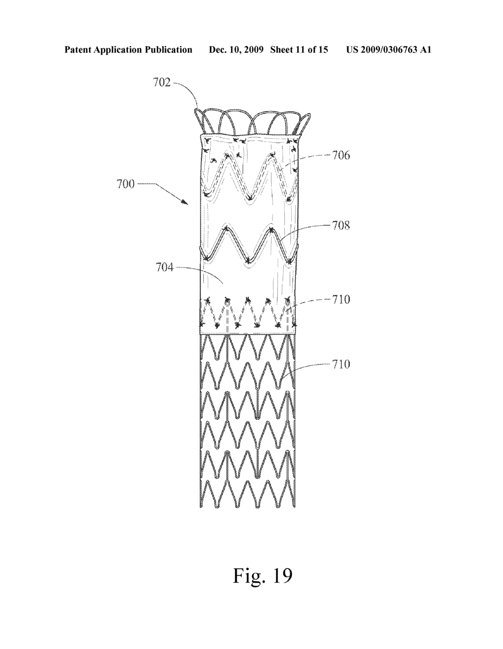 LOW PROFILE NON-SYMMETRICAL BARE ALIGNMENT STENTS WITH GRAFT - diagram, schematic, and image 12