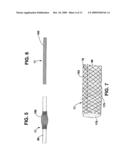 Compliant Blood Vessel Graft diagram and image