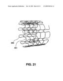 Compliant Blood Vessel Graft diagram and image