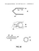 Compliant Blood Vessel Graft diagram and image