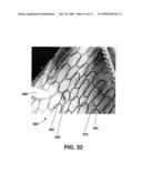 Compliant Blood Vessel Graft diagram and image