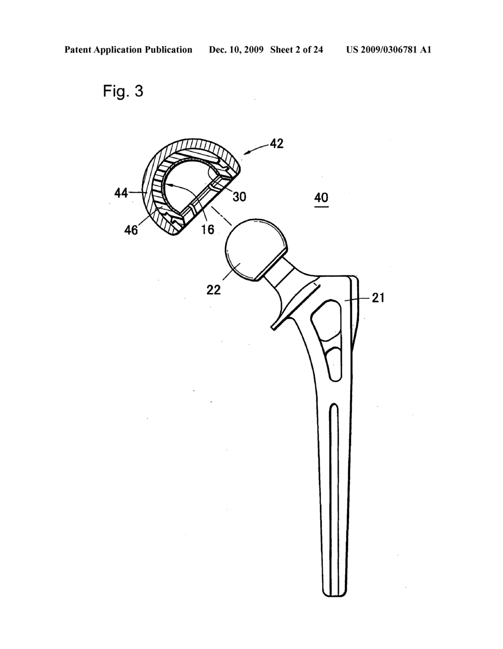 High Wear-Resistant Bearing Material and Artificial Joint Replacement Using the Same - diagram, schematic, and image 03