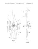 Total Knee Prosthesis and Method for Total Knee Arthroplasty diagram and image