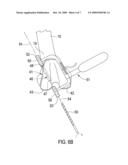 Total Knee Prosthesis and Method for Total Knee Arthroplasty diagram and image