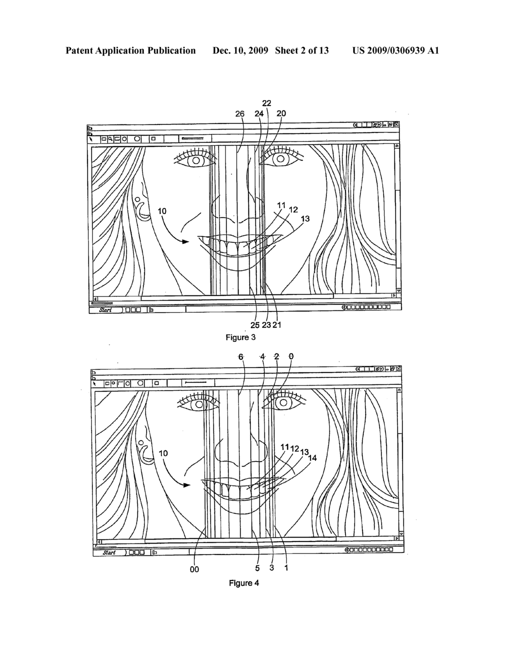 Dental analysis method and system - diagram, schematic, and image 03