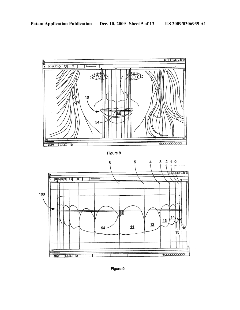 Dental analysis method and system - diagram, schematic, and image 06