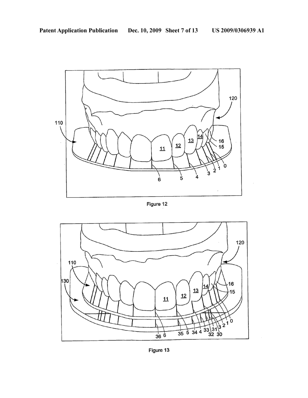 Dental analysis method and system - diagram, schematic, and image 08