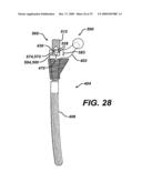 ASSEMBLY TOOL FOR MODULAR IMPLANTS AND ASSOCIATED METHOD diagram and image