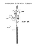 ASSEMBLY TOOL FOR MODULAR IMPLANTS AND ASSOCIATED METHOD diagram and image