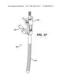 ASSEMBLY TOOL FOR MODULAR IMPLANTS AND ASSOCIATED METHOD diagram and image