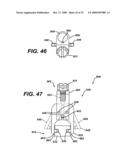 ASSEMBLY TOOL FOR MODULAR IMPLANTS AND ASSOCIATED METHOD diagram and image