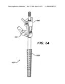 ASSEMBLY TOOL FOR MODULAR IMPLANTS AND ASSOCIATED METHOD diagram and image