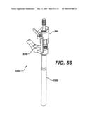 ASSEMBLY TOOL FOR MODULAR IMPLANTS AND ASSOCIATED METHOD diagram and image