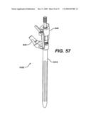 ASSEMBLY TOOL FOR MODULAR IMPLANTS AND ASSOCIATED METHOD diagram and image