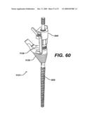 ASSEMBLY TOOL FOR MODULAR IMPLANTS AND ASSOCIATED METHOD diagram and image