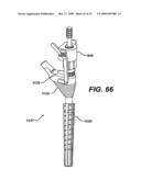 ASSEMBLY TOOL FOR MODULAR IMPLANTS AND ASSOCIATED METHOD diagram and image