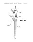 ASSEMBLY TOOL FOR MODULAR IMPLANTS AND ASSOCIATED METHOD diagram and image