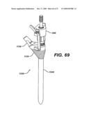 ASSEMBLY TOOL FOR MODULAR IMPLANTS AND ASSOCIATED METHOD diagram and image