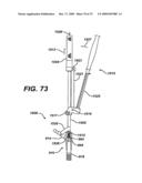 ASSEMBLY TOOL FOR MODULAR IMPLANTS AND ASSOCIATED METHOD diagram and image