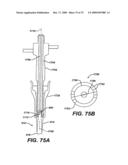 ASSEMBLY TOOL FOR MODULAR IMPLANTS AND ASSOCIATED METHOD diagram and image