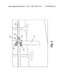 Temporary Arm Gain and Saddle diagram and image