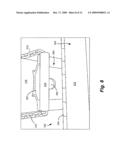 Temporary Arm Gain and Saddle diagram and image