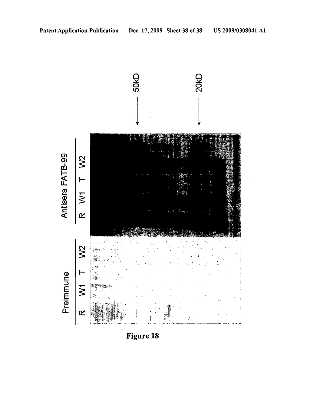 Altering the fatty acid composition of rice - diagram, schematic, and image 39