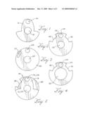 Laminated Counterweight for Timing Control diagram and image