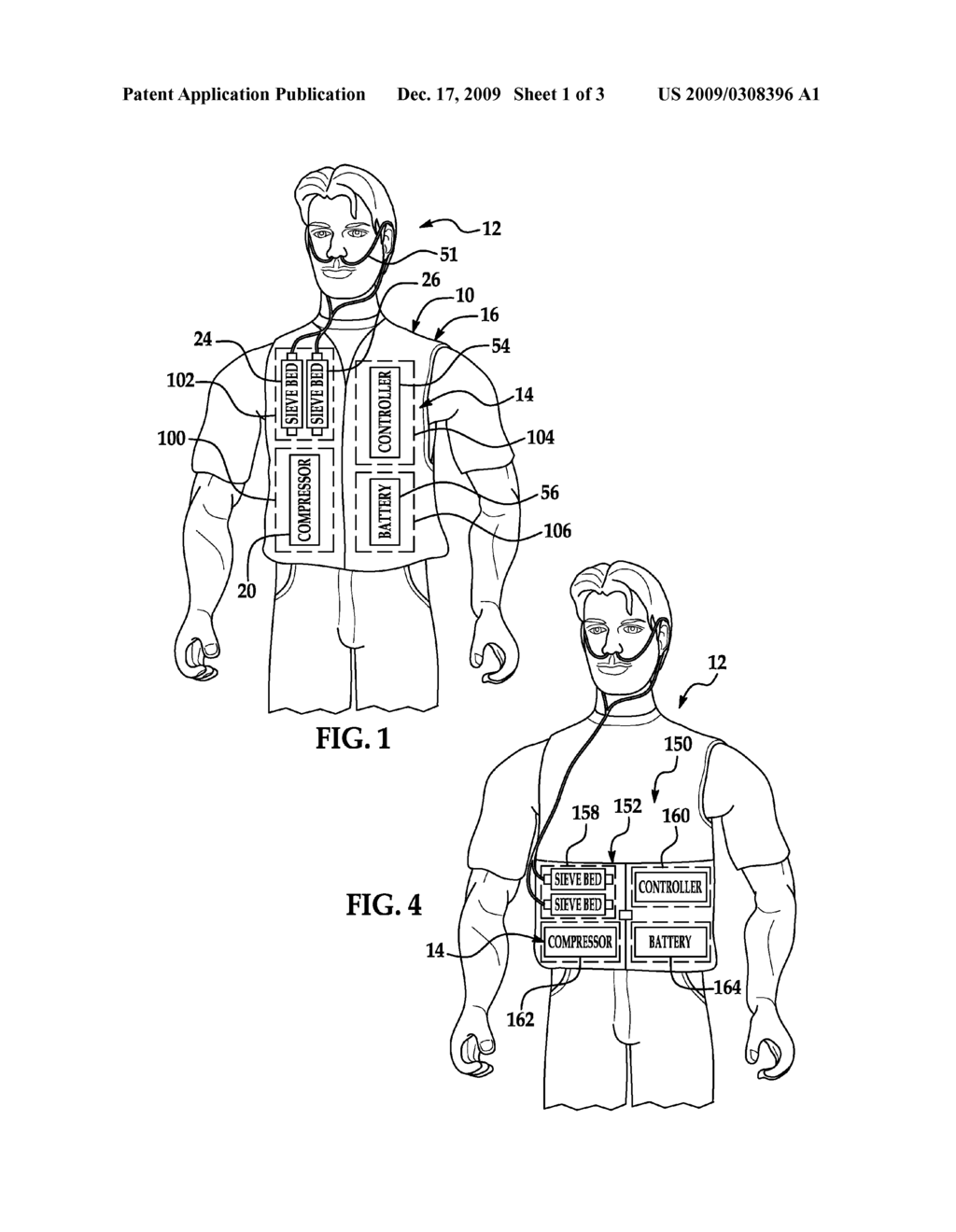 Wearable Oxygen Concentrator System - diagram, schematic, and image 02