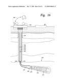 Method and Apparatus for a Monodiameter Wellbore, Monodiameter Casing, Monobore, and/or Monowell diagram and image