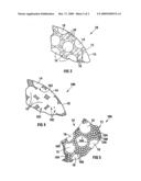 ORBITAL IMPLANT diagram and image