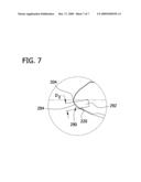 WIND TURBINE SENSOR ASSEMBLY AND METHOD OF ASSEMBLING THE SAME diagram and image