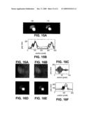 STRUCTURAL ILLUMINATION AND EVANESCENT COUPLING FOR THE EXTENSION OF IMAGING INTERFEROMETRIC MICROSCOPY diagram and image