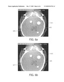 X-RAY DETECTOR GAIN CALIBRATION DEPENDING ON THE FRACTION OF SCATTERED RADIATION diagram and image