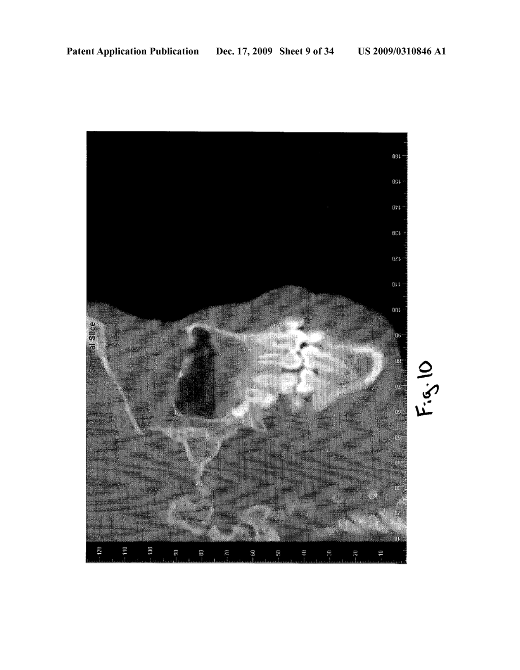 Apparatus and Method for Selectively Generating Graphic Medical Records from Continuous Multiplanar Viewing - diagram, schematic, and image 10