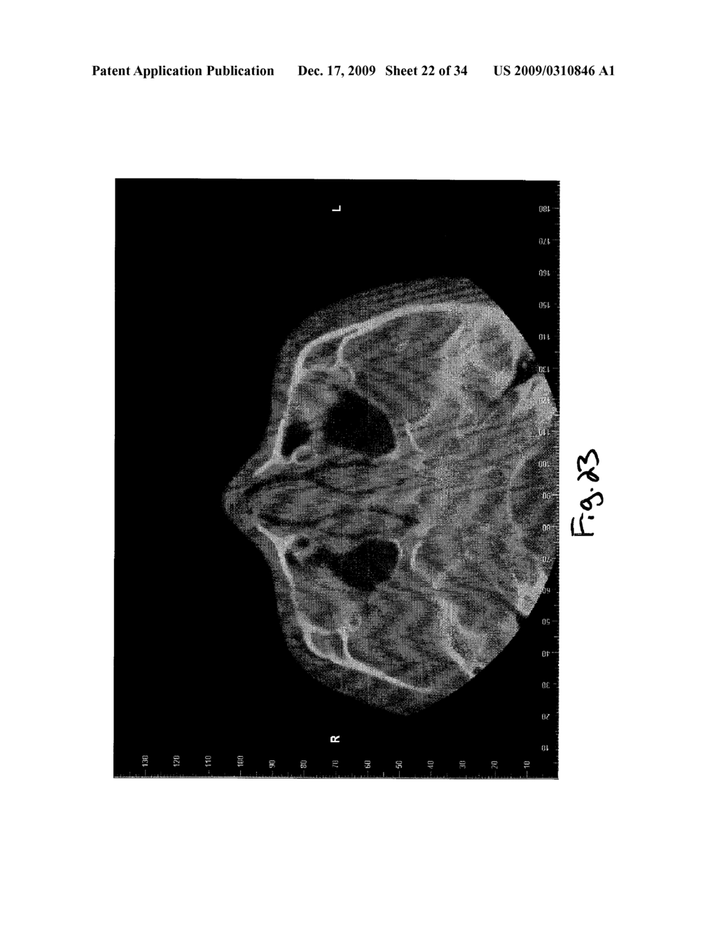 Apparatus and Method for Selectively Generating Graphic Medical Records from Continuous Multiplanar Viewing - diagram, schematic, and image 23