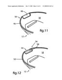 UV Sanitizer for Tethered and Untethered Mouthguards diagram and image