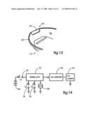 UV Sanitizer for Tethered and Untethered Mouthguards diagram and image