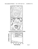 METHODS FOR TREATING THYROID CANCER diagram and image