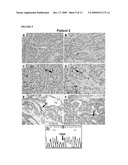 METHODS FOR TREATING THYROID CANCER diagram and image