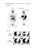 METHODS FOR TREATING THYROID CANCER diagram and image