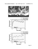 METHODS FOR TREATING THYROID CANCER diagram and image