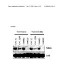 THERAPEUTIC AGENT COMPRISING LIPOCALIN 2 AGAINST CANCER METASTASIS, AND METHODS OF EARLY DIAGNOSIS AND INHIBITION OF CANCER METASTASIS USING LIPOCALIN 2 diagram and image