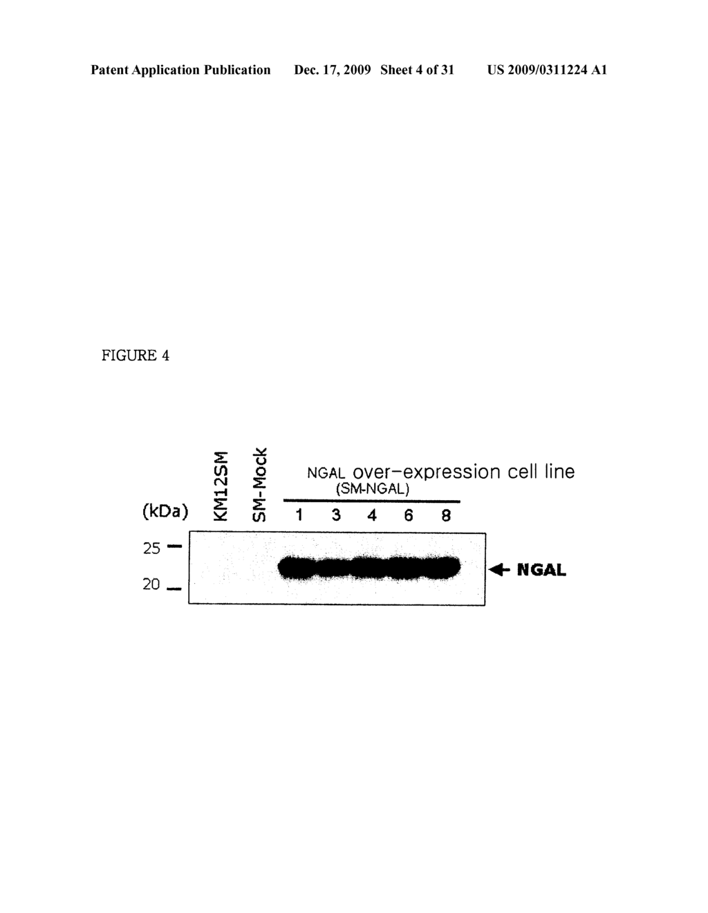 THERAPEUTIC AGENT COMPRISING LIPOCALIN 2 AGAINST CANCER METASTASIS, AND METHODS OF EARLY DIAGNOSIS AND INHIBITION OF CANCER METASTASIS USING LIPOCALIN 2 - diagram, schematic, and image 05