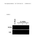 THERAPEUTIC AGENT COMPRISING LIPOCALIN 2 AGAINST CANCER METASTASIS, AND METHODS OF EARLY DIAGNOSIS AND INHIBITION OF CANCER METASTASIS USING LIPOCALIN 2 diagram and image