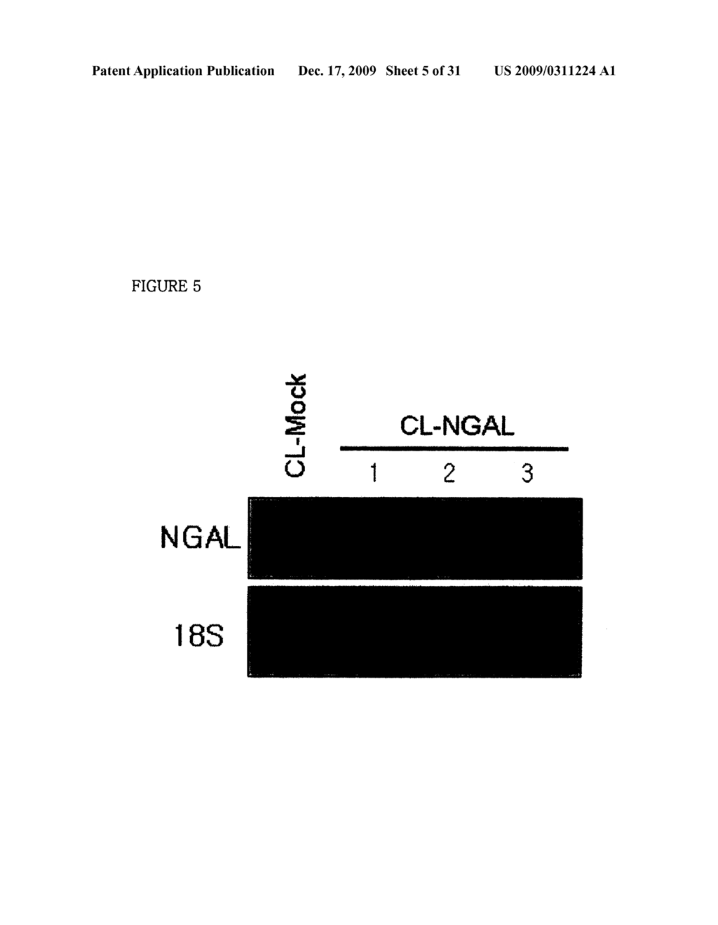 THERAPEUTIC AGENT COMPRISING LIPOCALIN 2 AGAINST CANCER METASTASIS, AND METHODS OF EARLY DIAGNOSIS AND INHIBITION OF CANCER METASTASIS USING LIPOCALIN 2 - diagram, schematic, and image 06