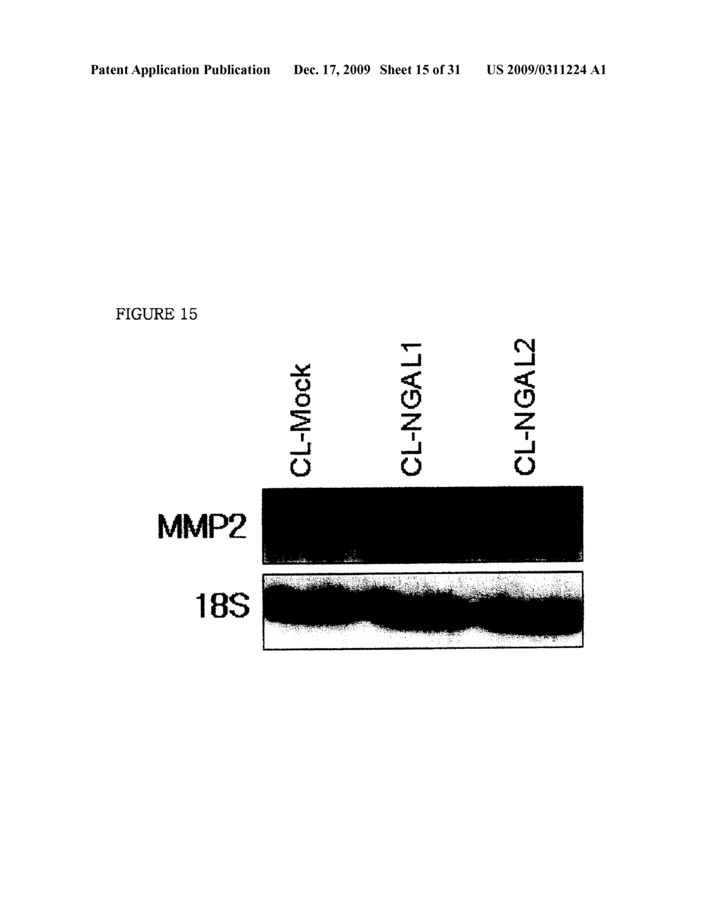 THERAPEUTIC AGENT COMPRISING LIPOCALIN 2 AGAINST CANCER METASTASIS, AND METHODS OF EARLY DIAGNOSIS AND INHIBITION OF CANCER METASTASIS USING LIPOCALIN 2 - diagram, schematic, and image 16